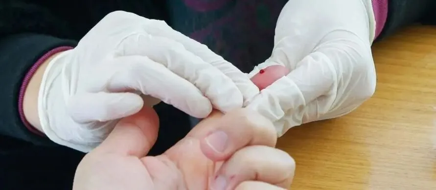 Aids: Brasil tem alta de casos, mas menor mortalidade desde 2013